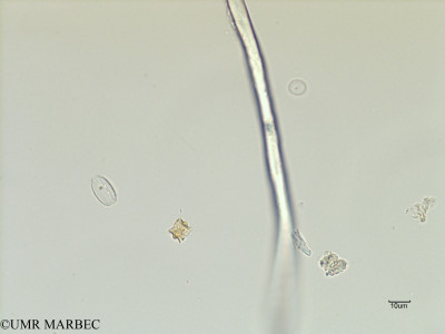 phyto/Scattered_Islands/iles_glorieuses/SIREME November 2015/Chaetoceros didymus (SIREME-Glorieuses2015-ech5-231116-photo6-2)(copy)_thumb.jpg
